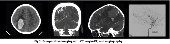 Preoperative-Imaging-with-CT