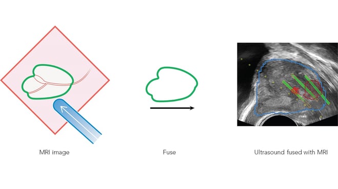 Urologist workflow_caption